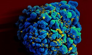 HIV-infected H9 T cell