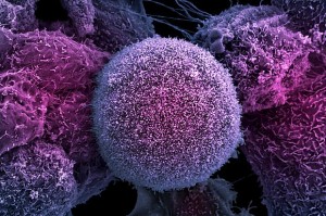 cancer cells image