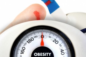 obesity and diabetes image