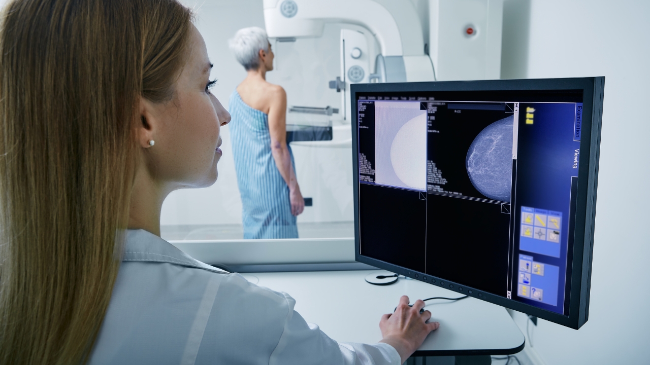 digital breast screening