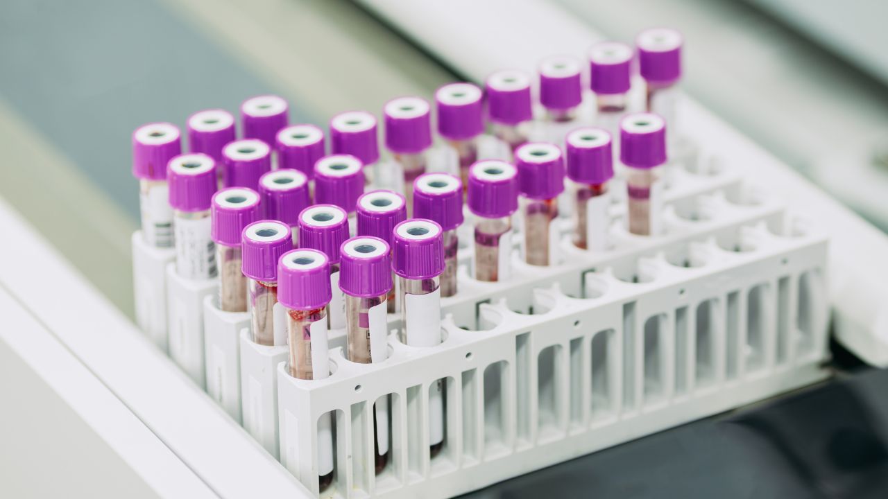 blood test for cancer